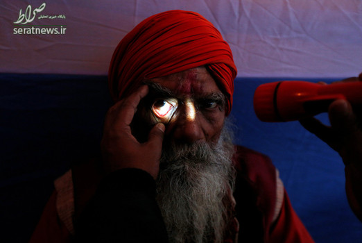 معاینه چشم یک مرتاض هندی در جریان برگزاری جشنواره یک روزه ماکار سانکرانتی ـ کلکته هند