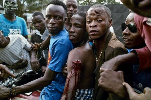 زخم دست یک حامی حزب مخالف دولت کنگو