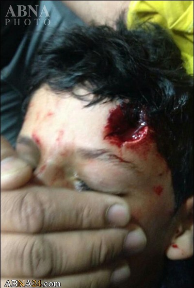 شلیک گلوله‌ به سرکودک بحرینی +عکس+18
