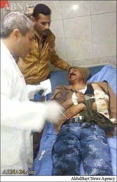 رئیس پلیس البغدادی زخمی شد +عکس