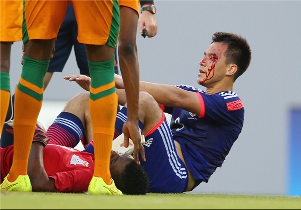 مصدومیت ملی‌پوش ژاپن قبل از جام جهانی + عکس