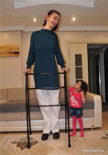 بلندقدترین دختر نوجوان جهان+عکس