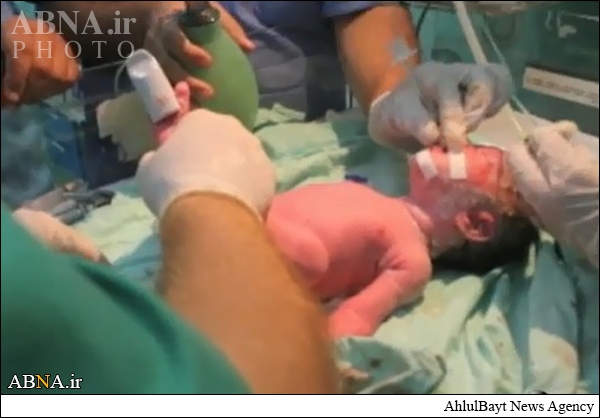 تولد نوزاد پس از شهادت مادرش +عکس