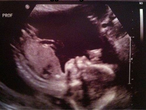 تصاویر شگفت‌انگیز از سونوگرافی جنین‌