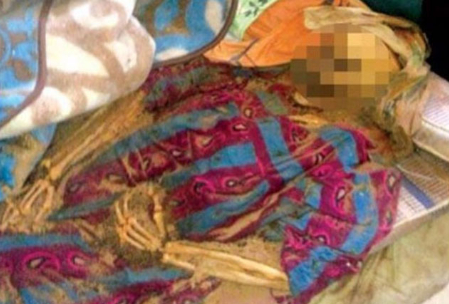 جسد مادری که دربسترش تجزيه شد!+عکس