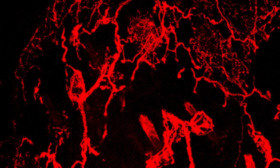 اعصاب بدنتان در زیر میکروسکوپ +تصاویر
