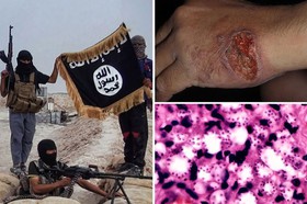 شیوع بیماری مرگبار میان داعشی‌ها +عکس