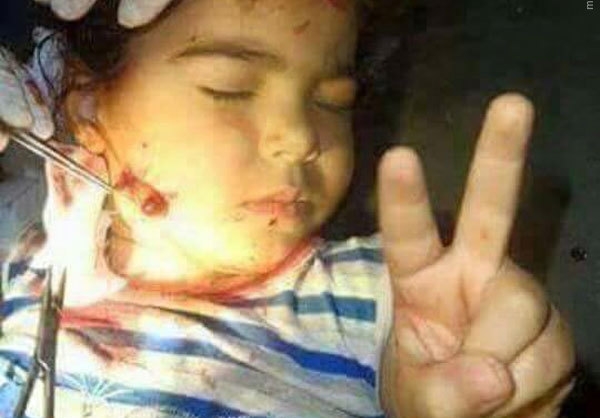 پاسخ کودک یمنی به آل سعود +عکس