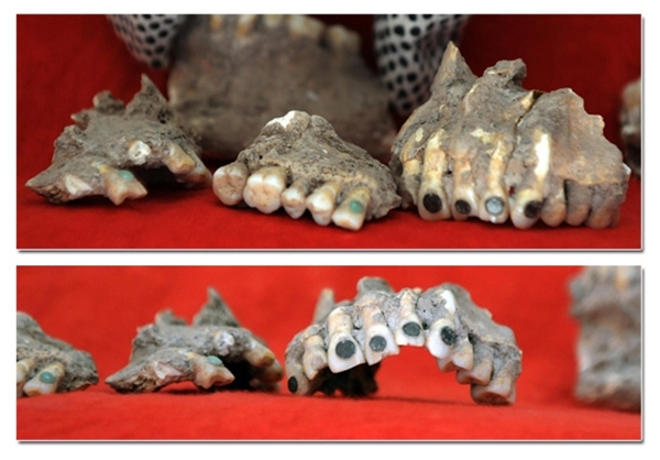 کشف شواهد دندانپزشکی در ۴۰۰۰سال پیش +عکس