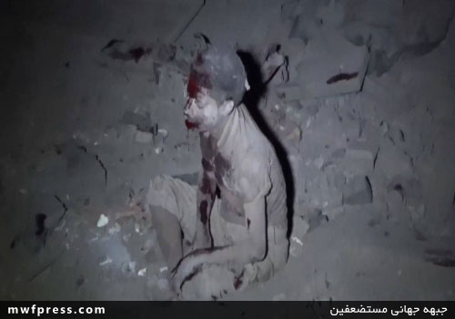 عکسی تکان‌دهنده از کودک مجروح یمنی