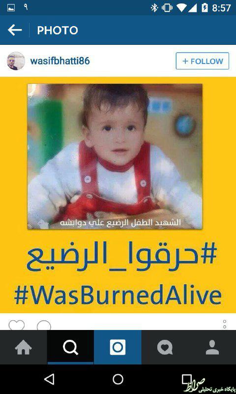 تصاویر نوزادی که صهیونیستها زنده‌زنده سوزاندند (18+)