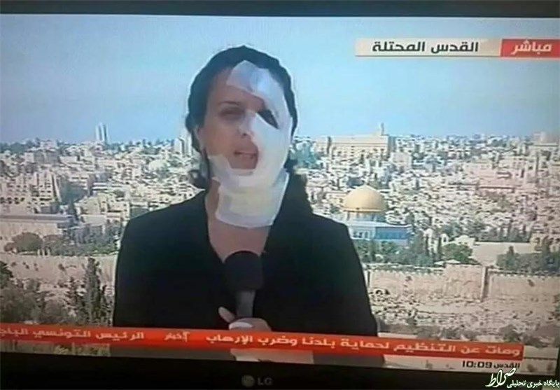 خبرنگار زخمی زن روی آنتن زنده +عکس