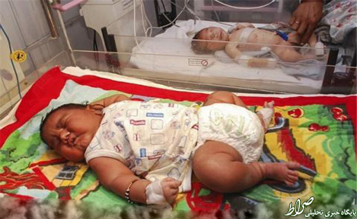 تولد نوزاد 5.8 کیلویی در هند +عکس