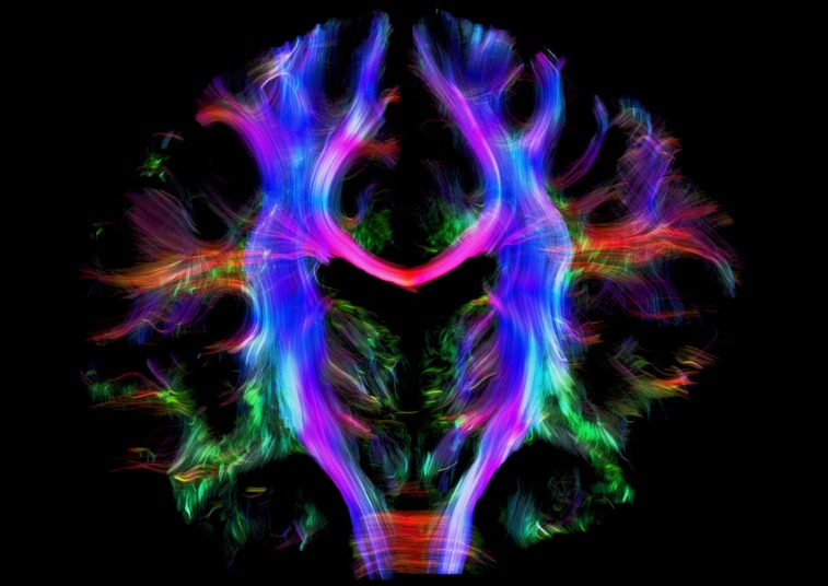 نقشه جالب سیم کشی ساختمان مغز انسان +عکس