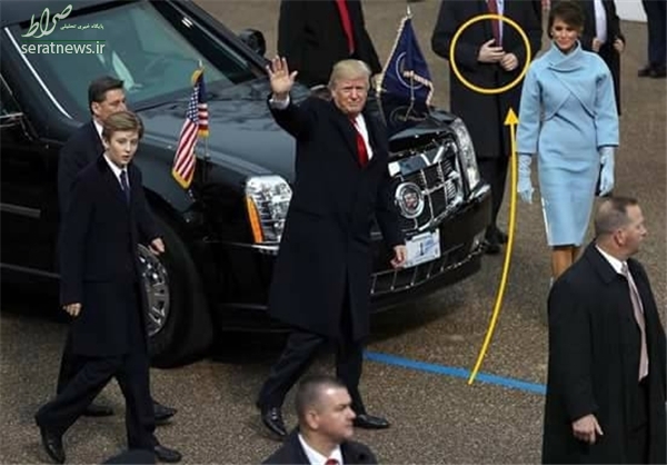 آیا دست محافظ ترامپ مصنوعی بود؟ +عکس