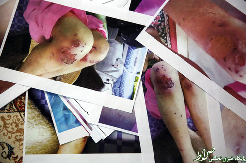 شکنجه 21 روزه زن بی پناه+تصاویر