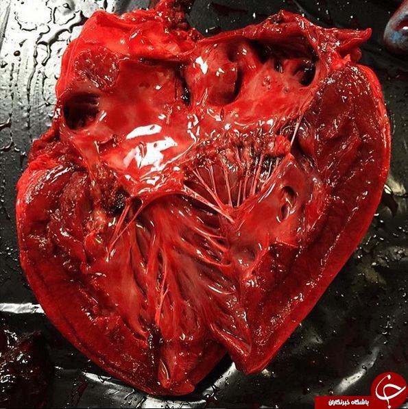 قلب انسان بعد از مردن +تصاویر