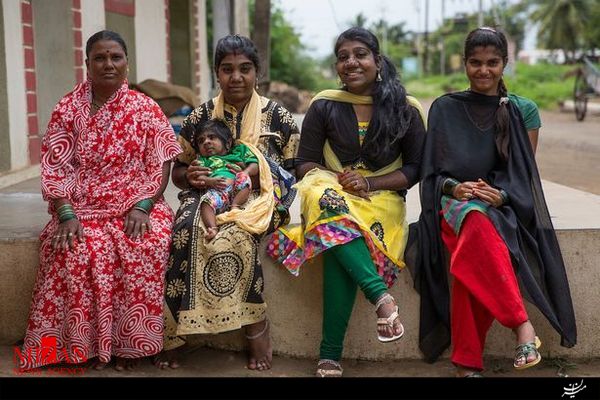 تولد پسر گرگ نما در هند+تصاویر