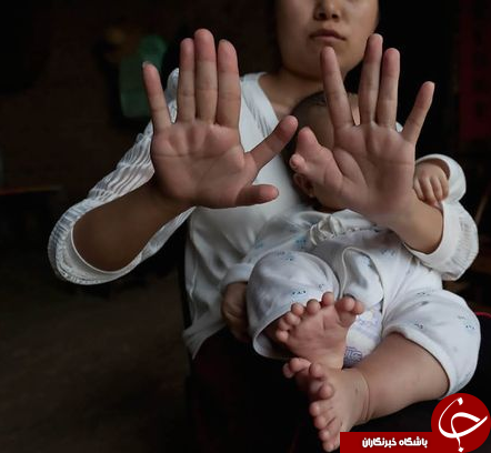 تولد نوزاد 31انگشتی در چین+عکس