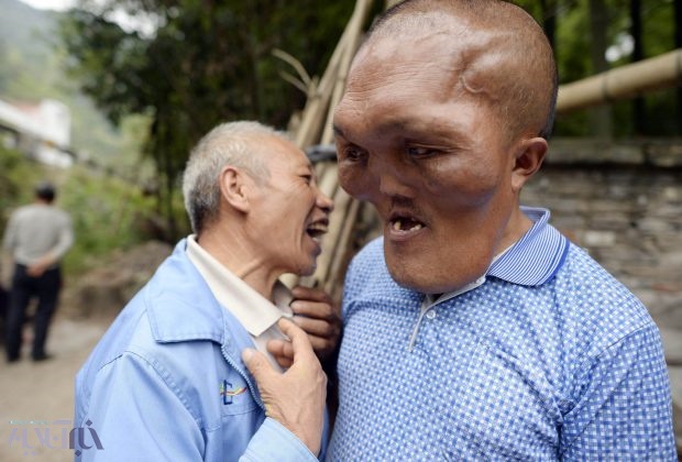 تصاویر/ بیماری عجیب و غریب مرد چینی