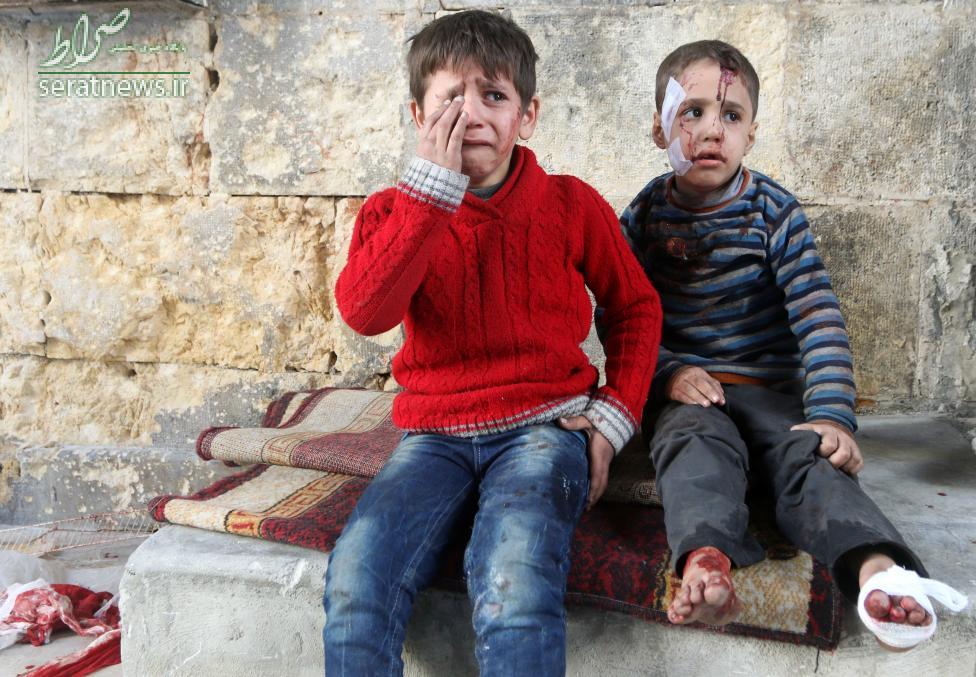عکس/کودکان مجروح در بمباران حلب