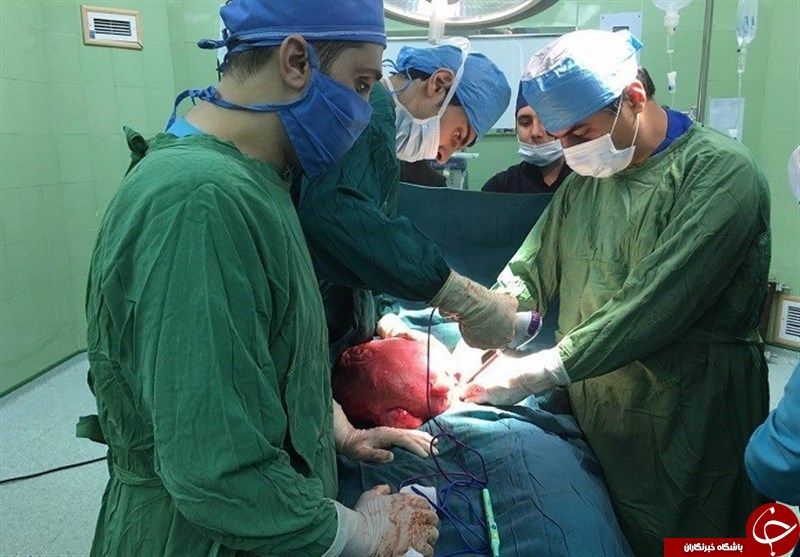 برداشتن توده ۷ کیلویی از بدن بیمار گلستانی