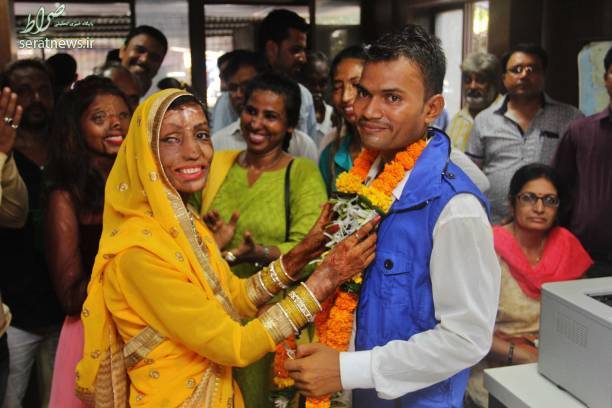نتیجه تصویری برای ازدواج عجیب هندی قربانی اسیدپاشی