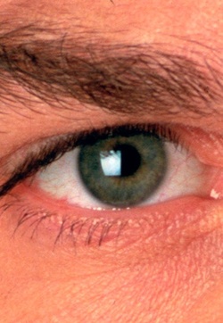 چشم‌های زیبا با آمپول ۴ میلیونی