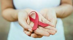 خطر یائسگی زودهنگام زنان مبتلا به HIV