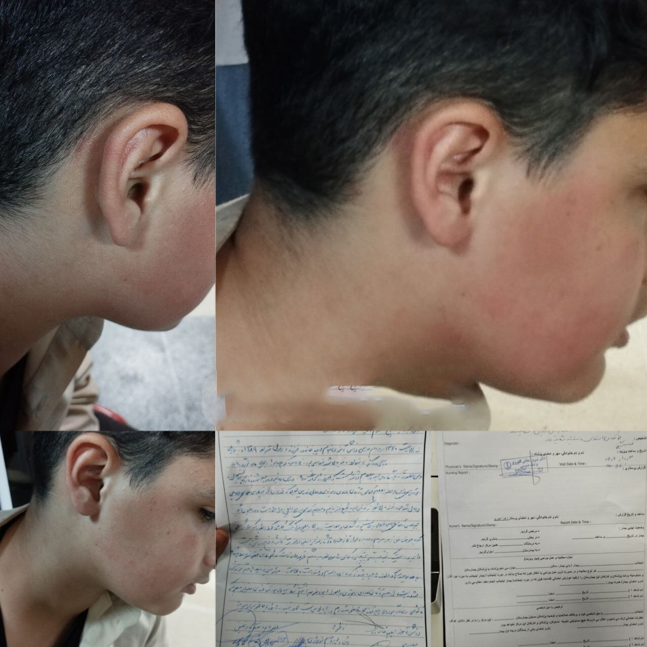 لغو ابلاغ معلم خاطی در پی تنبیه بدنی دانش آموز لاهیجانی | عکس