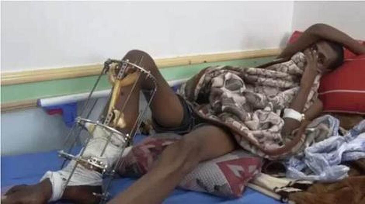 دیده‌بان حقوق بشر: کشتار پناهجویان اتیوپی به دست مرزبانی عربستان سعودی