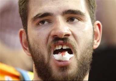 شکستن دندان بویان دوبلویچ در رقابت تیم?های والنسیا و کازان 