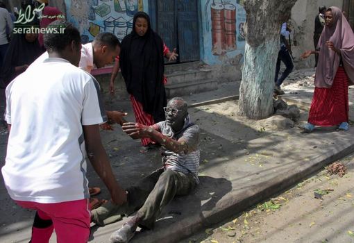 یک مرد زخمی پس از انفجار خودروی بمب گذاری شده در موگادیشو پایتخت سومالی